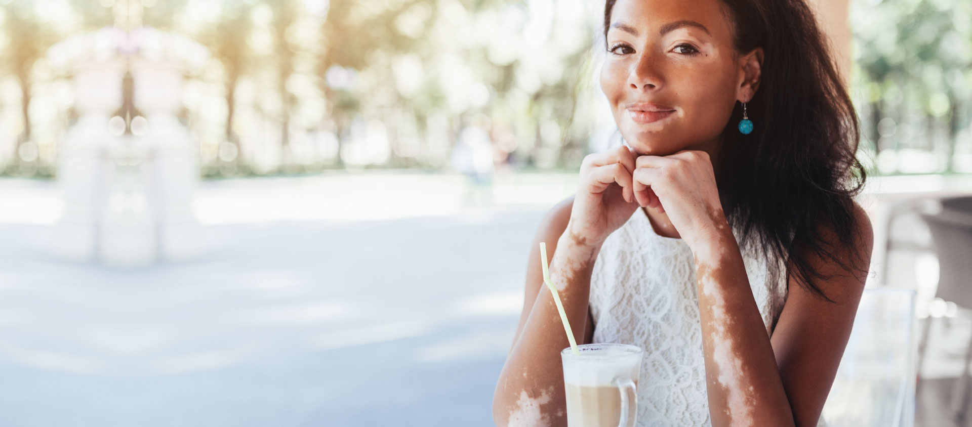 Vitiligo não tem cura, mas pode ser tratado; confira